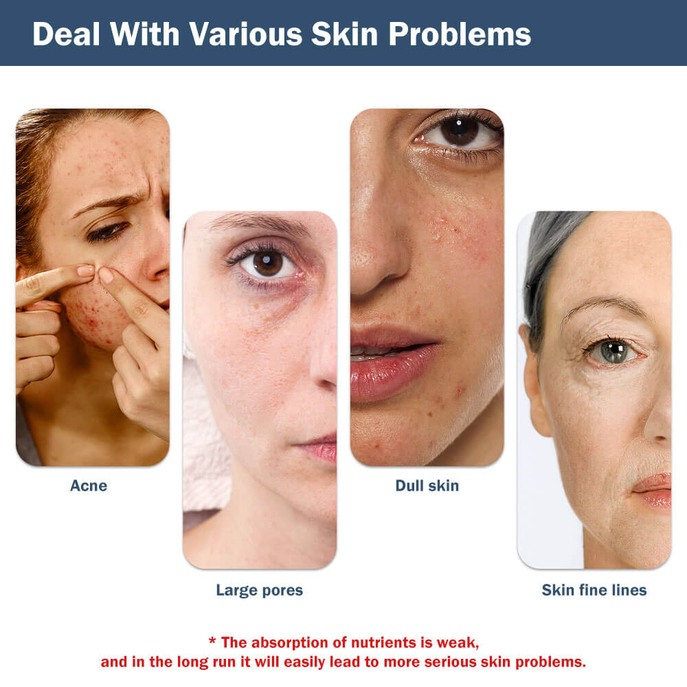 Skin Tightening Facial Machine for Skin Rejuvenation LED Light Therapy