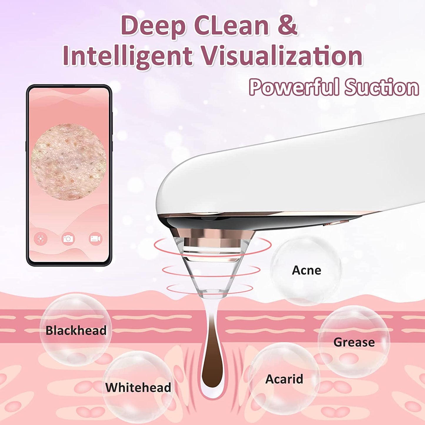 Blackhead Remover Pore Vacuum with Camera Visual Pore Vacuum Cleaner